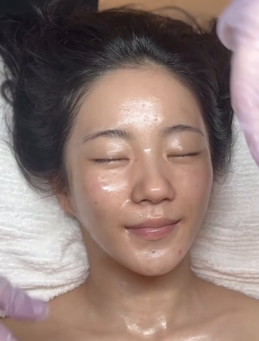 Glass skin result