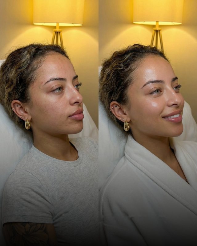 Before and after