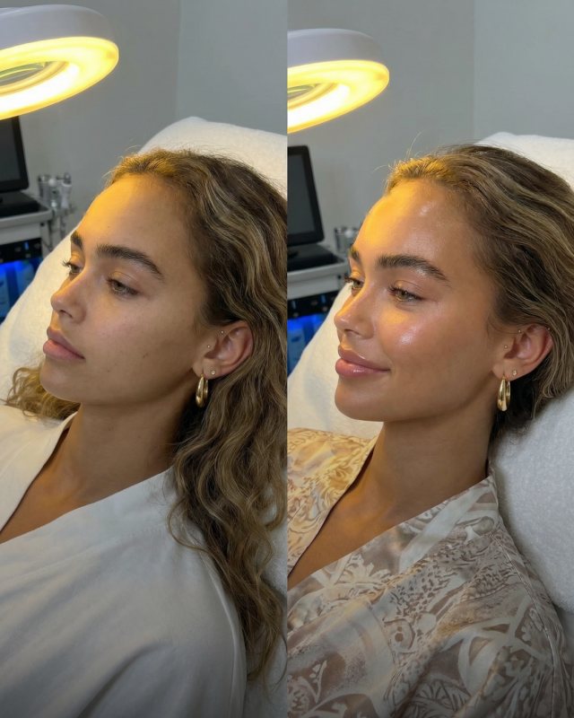 Before and after