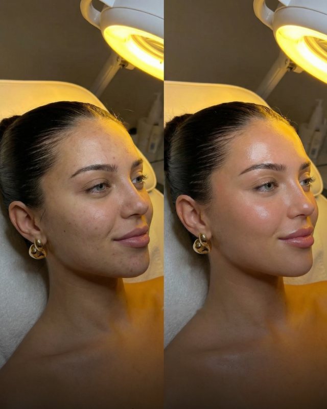 Before and after