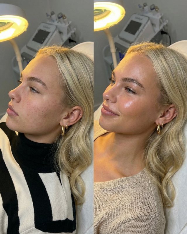 Before and after