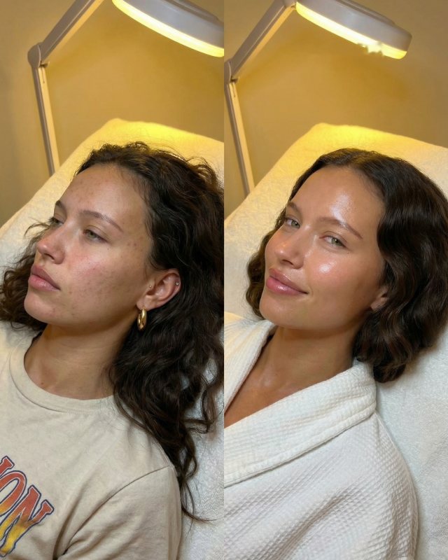Before and after