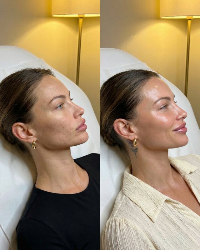 Before and after