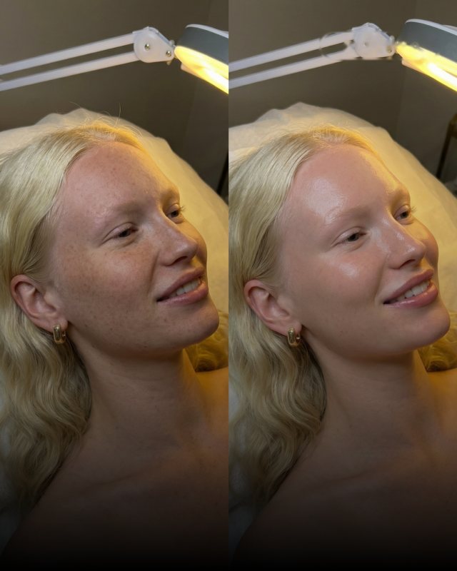 Before and after