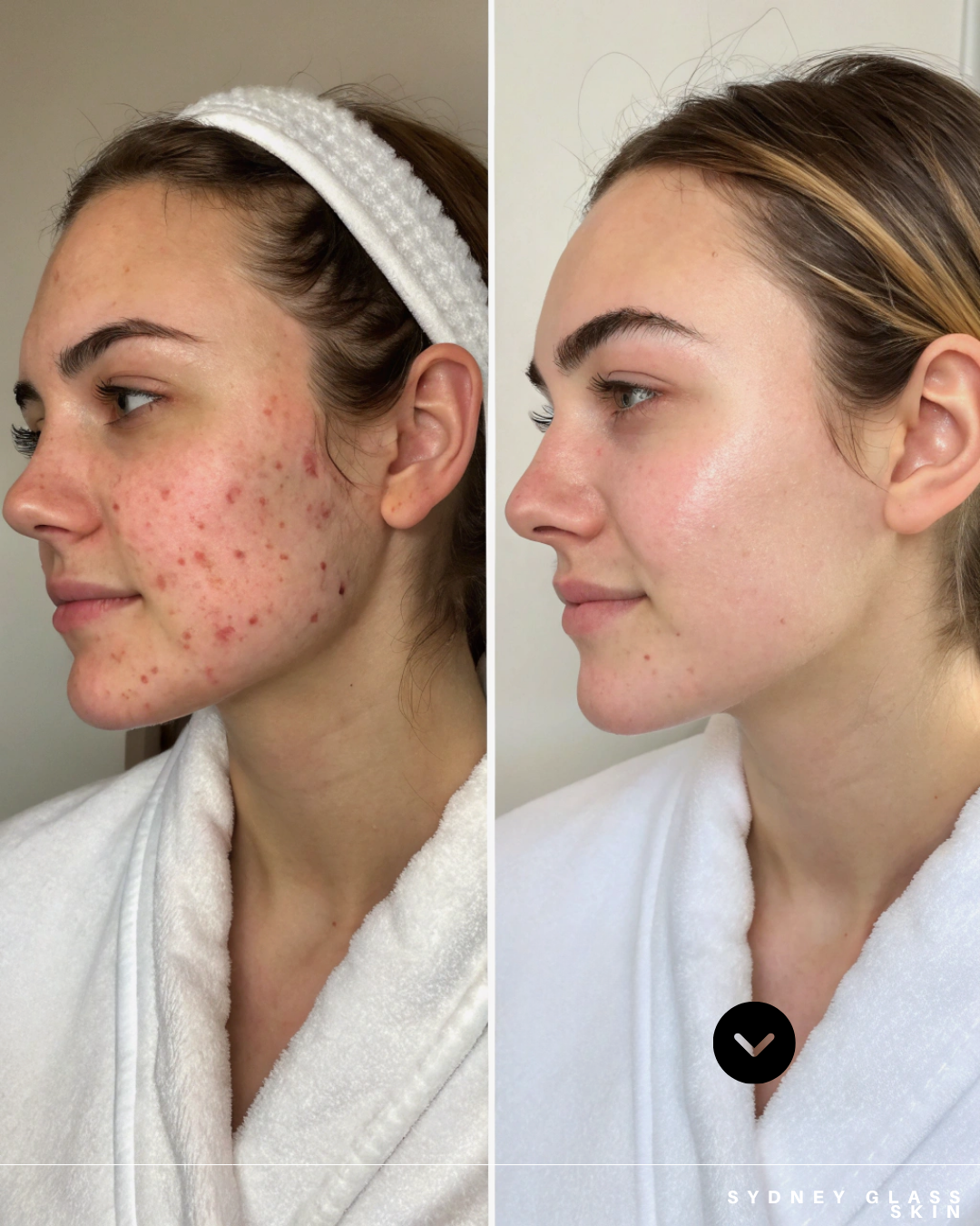 Before and after