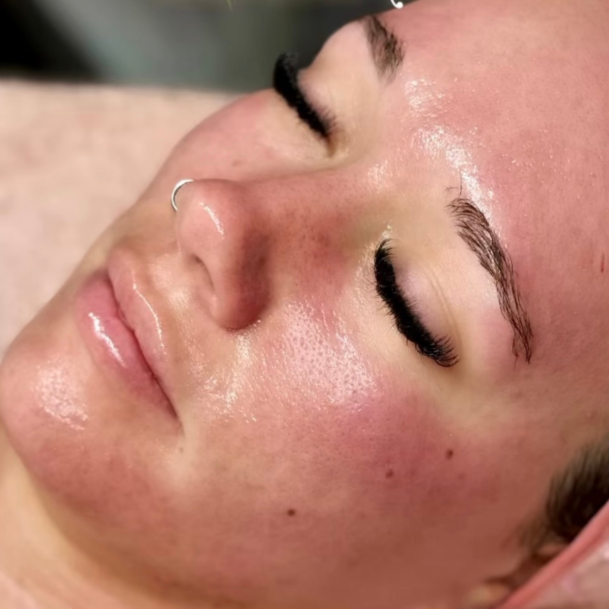 Glass Skin Result