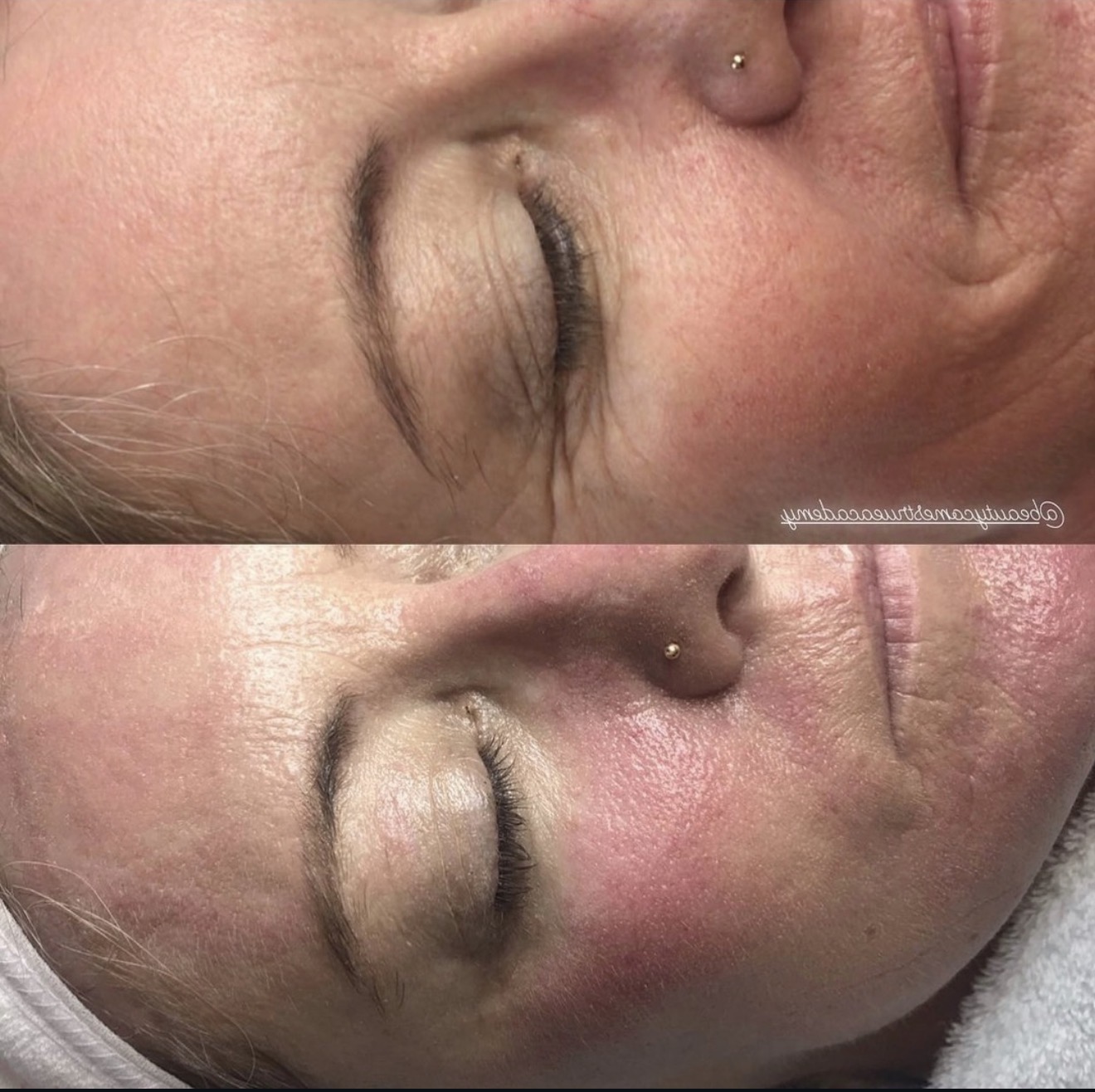 Before and after