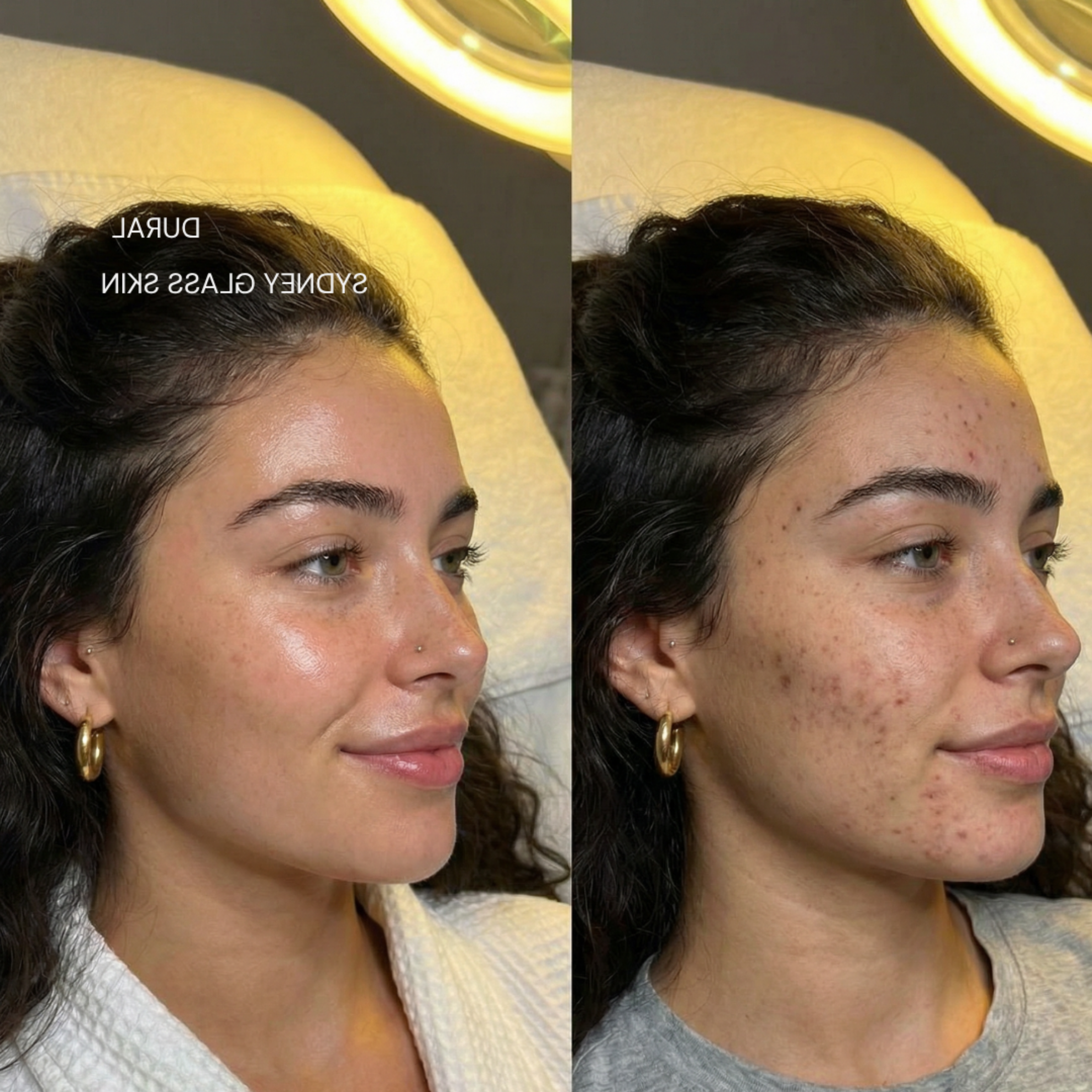 Before After