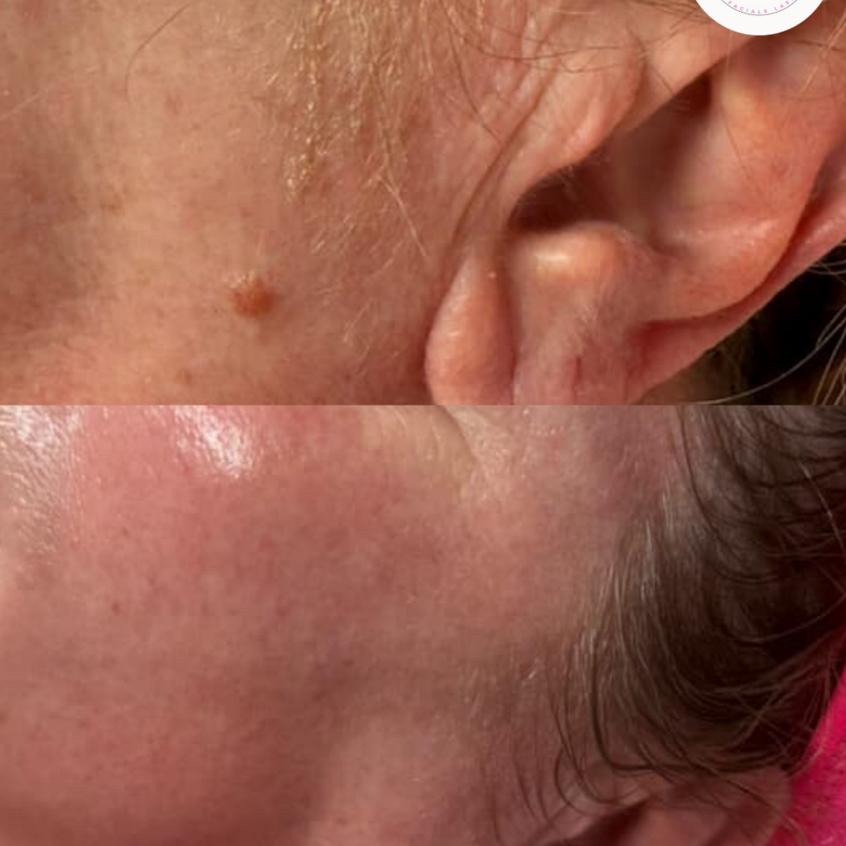 Before After