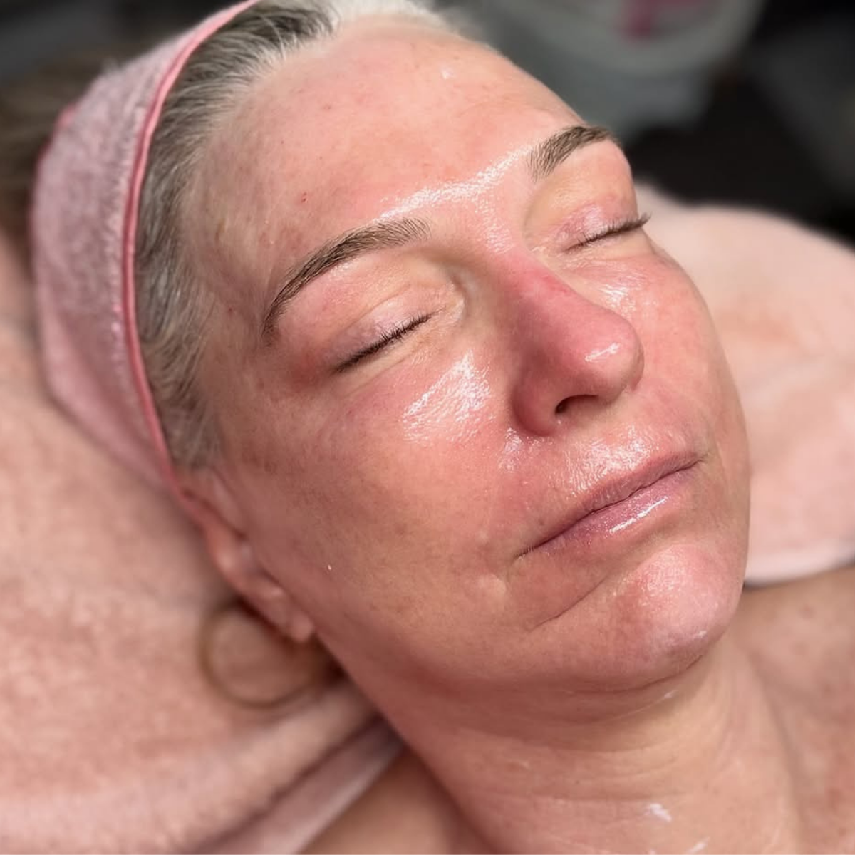 Glass Skin Result