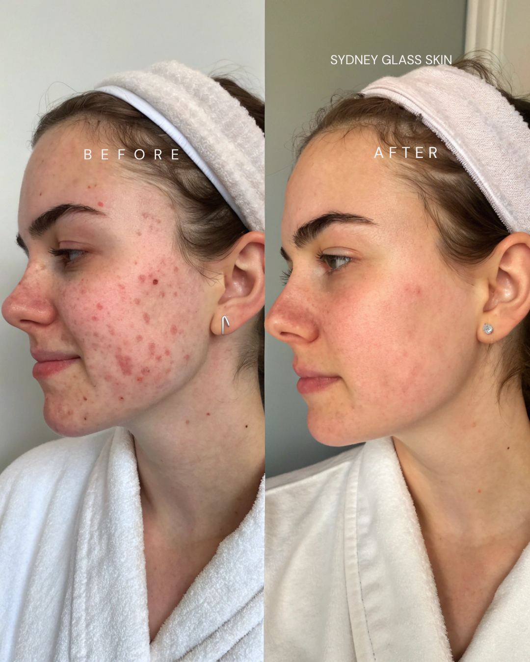 Before and after