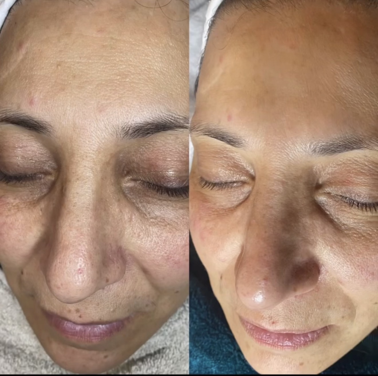 Before and after