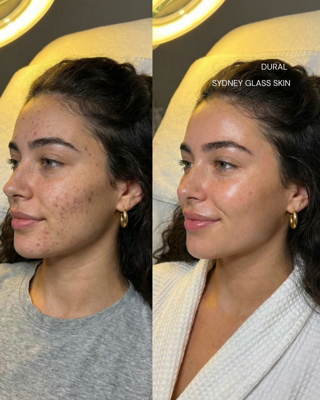 Before and after
