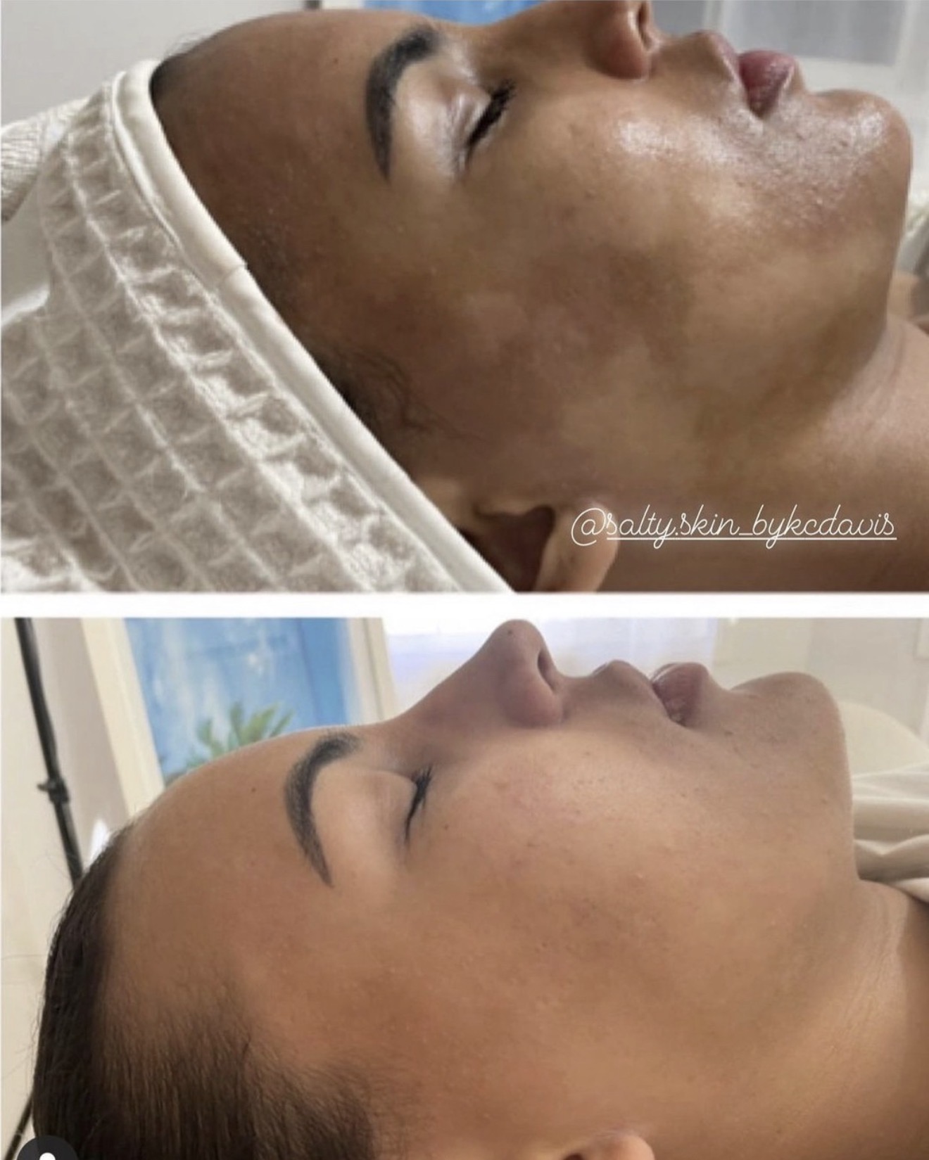 Before and after