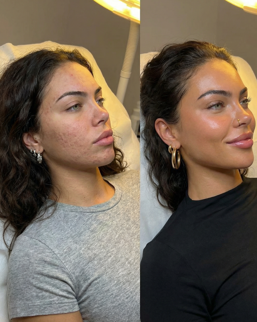 Before and after