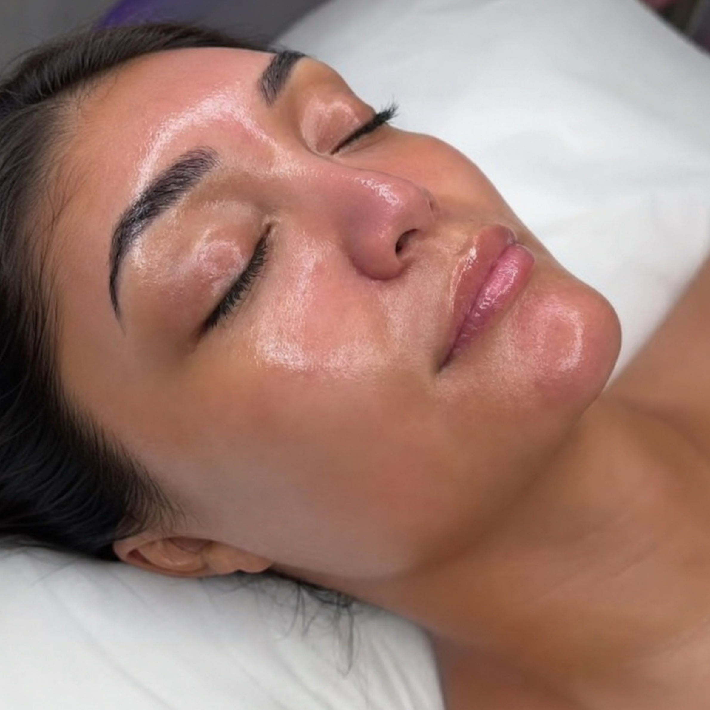 Glass Skin Result