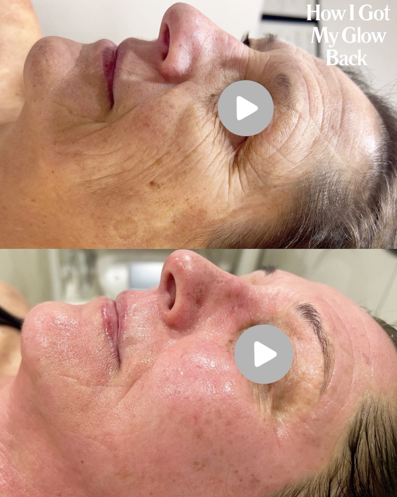 How I got my glow back before and after