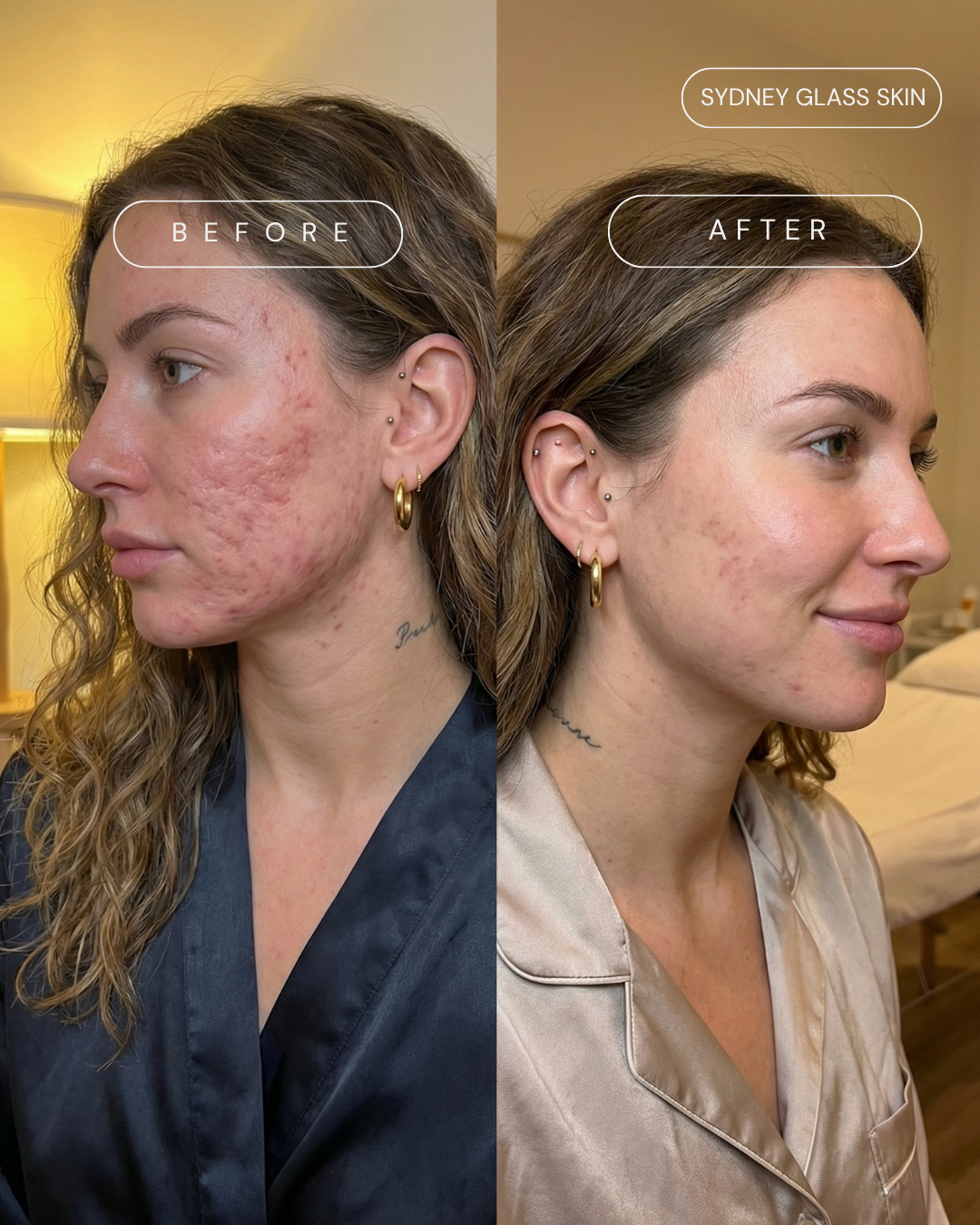 Before and after