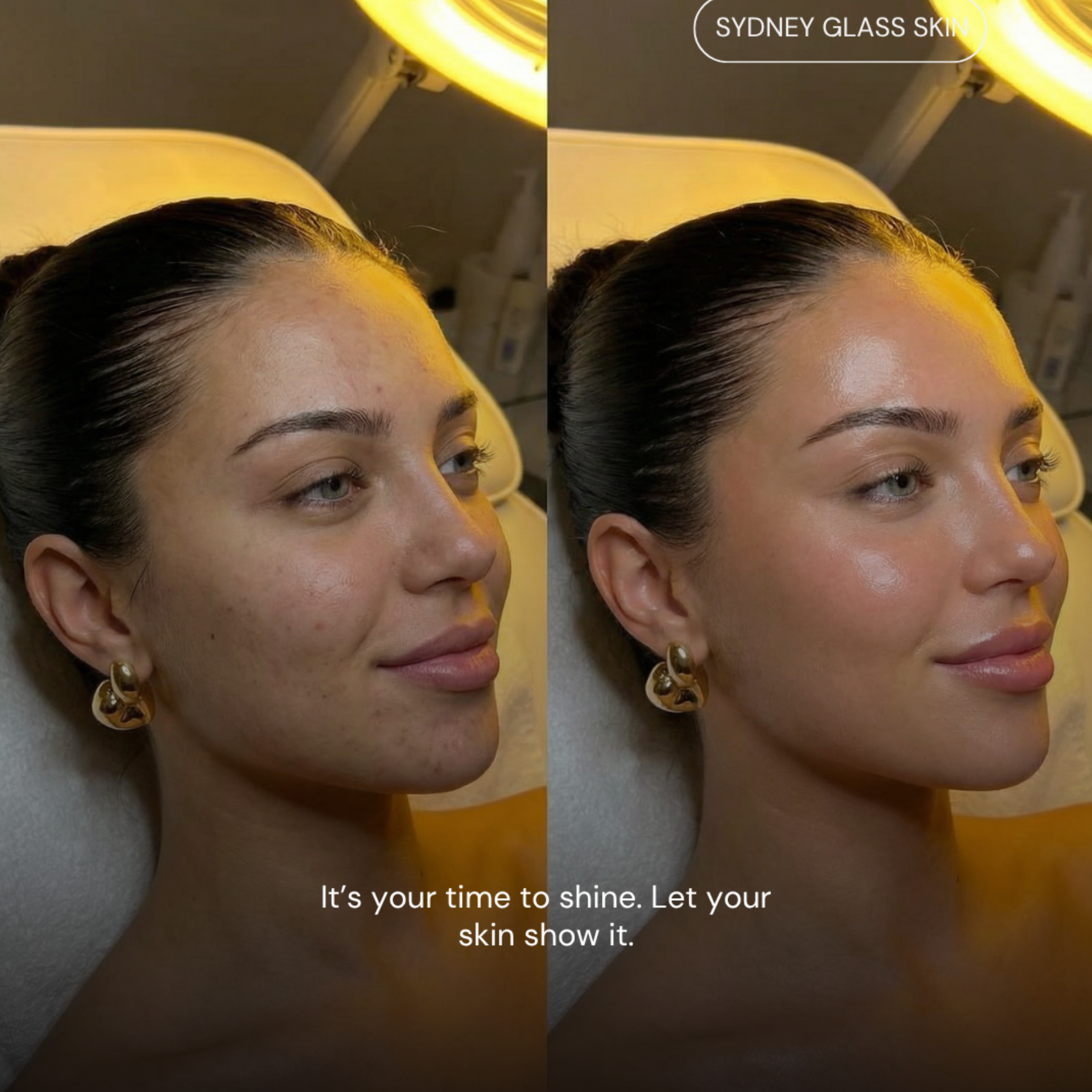 Before After