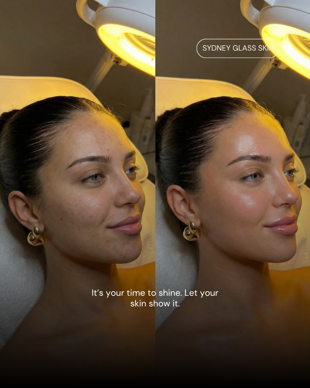 Before and after
