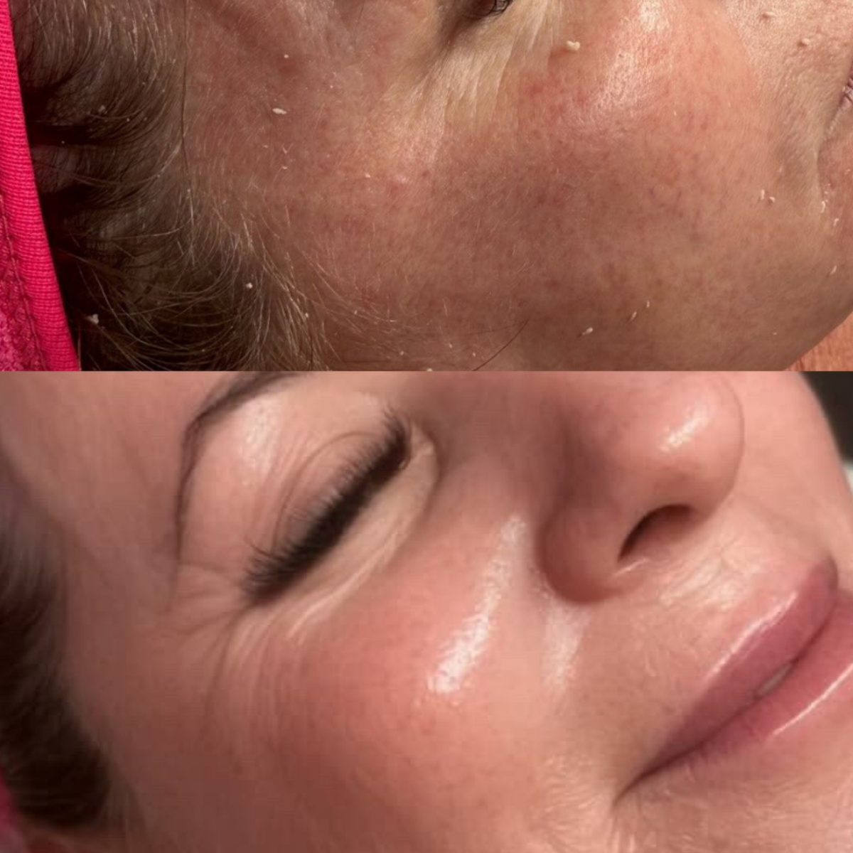 Before After